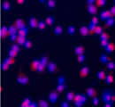 teaser_latz